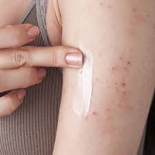 Which drugs can treat eczema